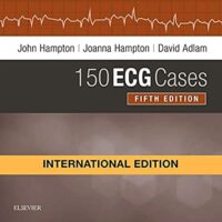 150 ECG CASES, INTERNATIONAL EDITION:  5ED