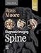 DIAGNOSTIC IMAGING: SPINE:  4ED