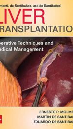 LIVER TRANSPLANTATION (MH SURGICAL SPECIALTY SERIES)