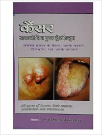 CANCER DIAGNOSIS AND TREATMENT
