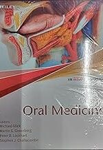 BURKET'S ORAL MEDICINE 13/ED 2022 AN INDIAN ADAPTATION
