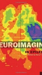 NEUROIMAGING IN EPILEPSY