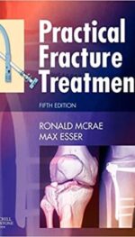PRACTICAL FRACTURE TREATMENT, INTERNATIONAL EDITION, 5E