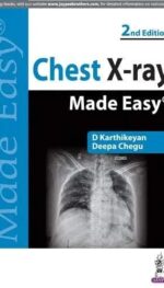 CHEST X-RAY MADE EASY