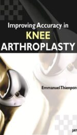 IMPROVING ACCURACY IN KNEE ARTHOPLASTY (POD)