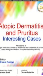 ATOPIC DERMATITIS AND PRURITUS INTERESTING CASES (POD)