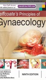 JEFFCOATE?S PRINCIPLES OF GYNAECOLOGY