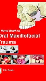 A HANDBOOK OF ORAL MAXILLOFACIAL TRAUMA