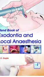 HANDBOOK OF EXODONTIA AND LOCAL ANAESTHESIA