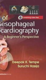 ATALS OF TRANSESOPHAGEAL ECHOCARDIOGRAPHY A BEGINNERS PERSPECTIVE (INCLUDED CD CONTAINING VIDEO FILES) (HB 2017)