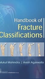 HANDBOOK OF FRACTURE CLASSIFICATIONS (PB 2017)