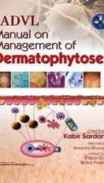 IADVL MANUAL ON MANAGEMENT OF DERMATOPHYTOSES (HB 2018)