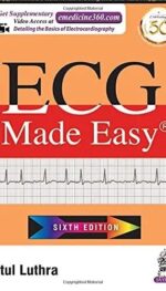 ECG MADE EASY
