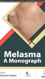 MELASMA A MONOGRAPH 4/ED2024