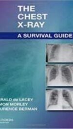 THE CHEST X-RAY: A SURVIVAL GUIDE, 1E