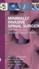 MINIMALLY INVASIVE SPINAL SURGERY