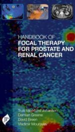 HANDBOOK OF FOCAL THERAPY FOR PROSTATE AND RENAL CANCER
