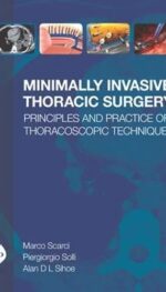 MINIMALLY INVASIVE THORACIC SURGERY: PRINCIPLES AND PRACTICE OF THORACOSCOPIC TECHNIQUE