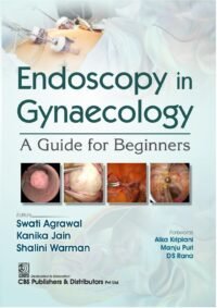 ENDOSCOPY IN GYNAECOLOGY A GUIDE FOR BEGINNERS 1/ED 2025