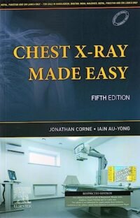 Chest X-Ray Made Easy, 5e