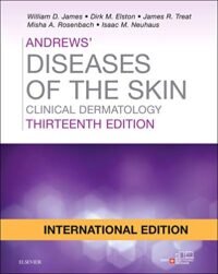 ANDREWS' DISEASES OF THE SKIN, INTERNATIONAL EDITION: CLINICAL DERMATOLOGY 13ED