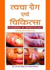 TWACHA ROG AND CHIKITSA (HANDBOOK OF DERMATOLOGY)