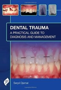 Dental Trauma: A Practical Guide to Diagnosis and Management