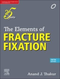 The Elements of Fracture Fixation, 5e