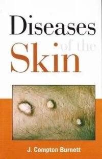 DISEASES OF THE SKIN