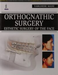 Orthognathic Surgery: Esthetic Surgery of the Face