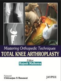 Mastering Orthopedic Techniques Total Knee Arthroplasty (POD)