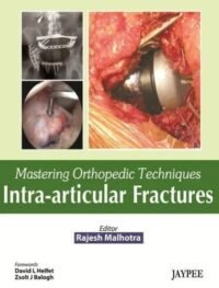 Mastering Orthopedic Techniques Intra-articular Fractures (POD)