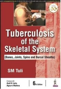Tuberculosis of the Skeletal System (Bones, Joints, Spine and Bursal Sheaths)