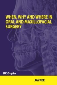 When, Why and Where in Oral and Maxillofacial Surgery (POD)