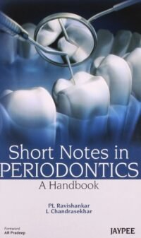 Short Notes in Periodontics A Handbook (POD)