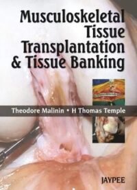 Musculoskeletal Tissue Transplantation & Tissue Banking