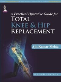A Practical Operative Guide for Total Knee and Hip Replacement (POD)