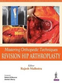 Mastering Orthopedic Techniques Revision Hip Arthroplasty