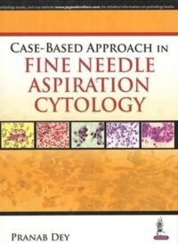 Case Based Approach in Fine Needle Aspiration Cytology
