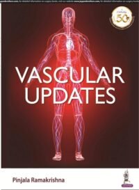 Vascular Updates (POD)
