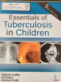 Essentials of Tuberculosis in Children
