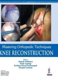 Mastering Orthopedic Techniques Knee Reconstruction