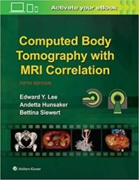 Computed Body Tomography with MRI Correlation South Asian Edition
