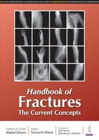 HANDBOOK OF FRACTURES THE CURRENT CONCEPTS