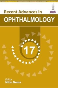 Recent Advances in Ophthalmology-17